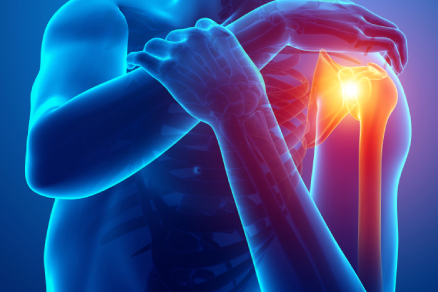 Reverse Total Shoulder Replacement