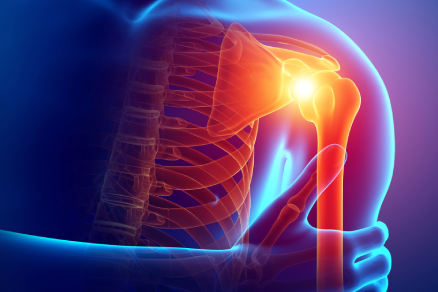 Shoulder Replacement Surgery